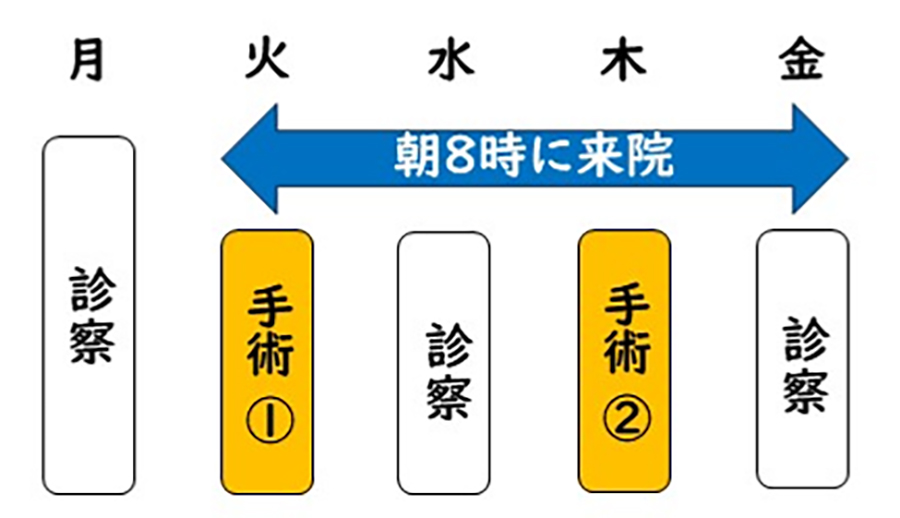 外来（日帰り）白内障手術（両眼の場合）